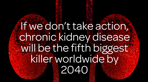 Kidney_fact_4_BloodyAmazingKidneys.png