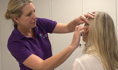 Acupuncture - Zoe