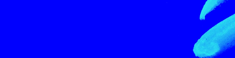 UP - The Adult Cerebral Palsy Movement banner